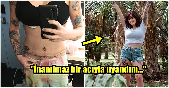 Meme Küçültme Ameliyatı Olmak İsterken Doktorların Kendisine Meme İmplantı Yaptığını İddia Eden Kadın