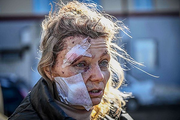 Ancak geçtiğimiz gün, görselin 2018 yılında gaz patlaması sonucu yaralanan kadının fotoğrafı olduğu iddia edildi.