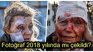 Rusya ve Ukrayna Arasındaki Savaşın Simgesi Haline Gelen Yaralı Kadın Fotoğrafının Etkileyici Hikayesi