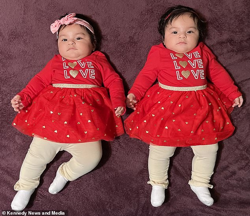 Американка родила двух девочек, зачатых с разницей в пять дней, и они НЕ близнецы!