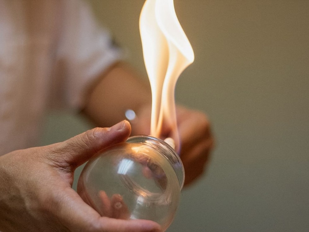 FETÖ Sanığından İlginç Savunma: '10 Yıldır Hobi Olarak Hacamat Yapıyorum'