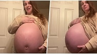 Böylesini Görmediniz: Aşırı Büyük Karnı Yüzünden Görenlerde Şok Etkisi Yaratan Hamile Kadın