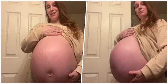 Böylesini Görmediniz: Aşırı Büyük Karnı Yüzünden Görenlerde Şok Etkisi Yaratan Hamile Kadın