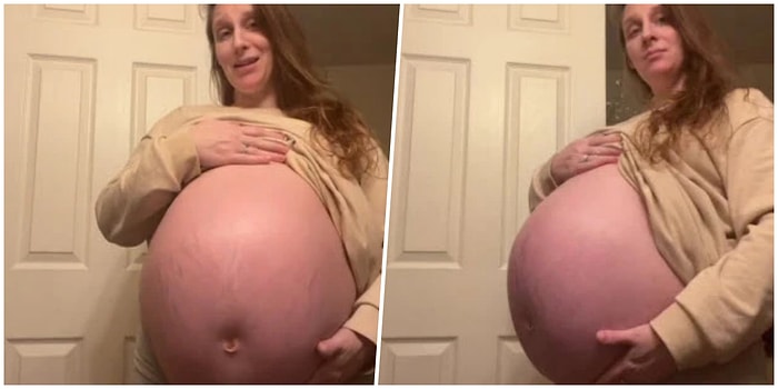 Böylesini Görmediniz: Aşırı Büyük Karnı Yüzünden Görenlerde Şok Etkisi Yaratan Hamile Kadın