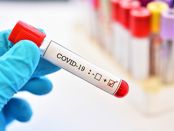 5 Mart Koronavirüs Tablosu Açıklandı mı? Vefat ve Vaka Sayısı Kaç Oldu?