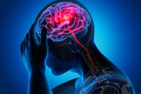Yüzde 96'sı hafif Kovid-19 semptomları taşımış 401 kişinin beyinleri hastalıklarından yaklaşık 4,5 ay sonra yeniden görüntülendi. Araştırma kapsamında hastalık geçirmeyen 384 kişi de incelendi.