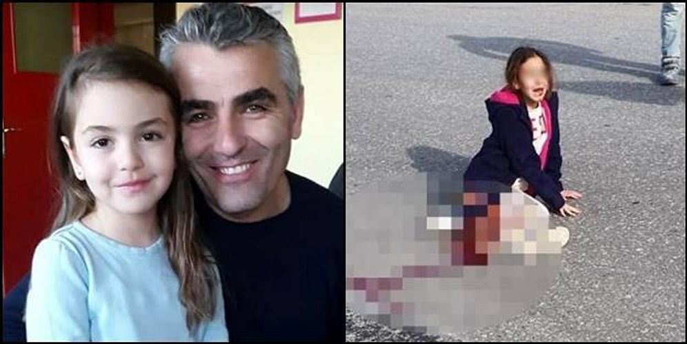 Köpekten Kaçarken Sağ Bacağını Kaybeden Mahra'nın Babası: 'Beyin Ölümü Gerçekleşebilir'