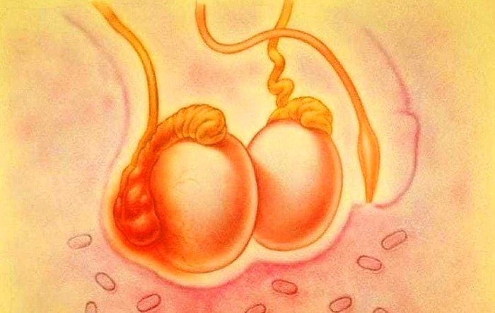 İnmemiş Testis Nedir? Belirtileri ve Tedavisi…