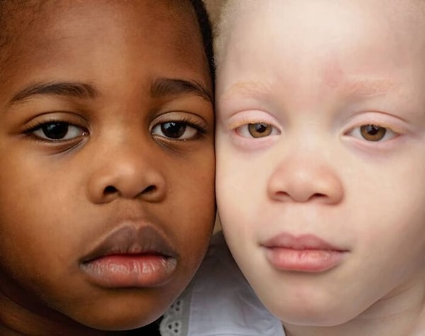 «Я не была удивлена, потому что думал, что это ошибка. Я думала, что мне дали не того ребенка»