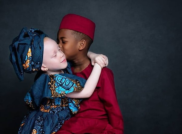 По словам Джудит, люди удивляются, когда узнают, что Камси и Качи — близнецы.