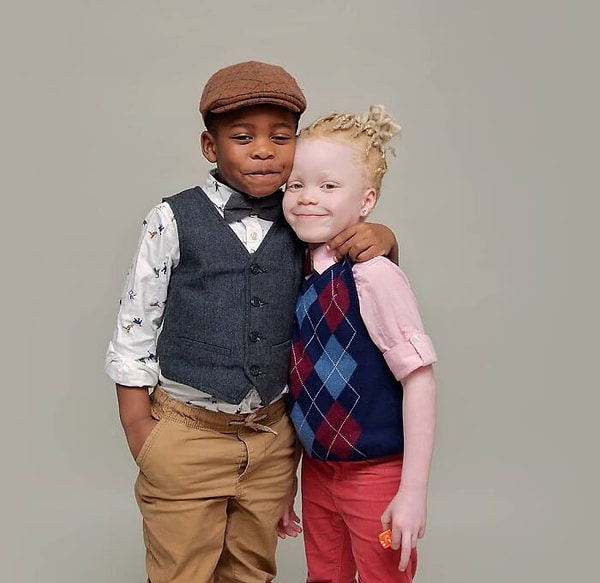 «Когда они у меня появились, я молилась, чтобы цвет кожи моей дочери стал черным. Сегодня я не хотела бы, чтобы она была другой, даже за миллион долларов. Альбинизм прекрасен»