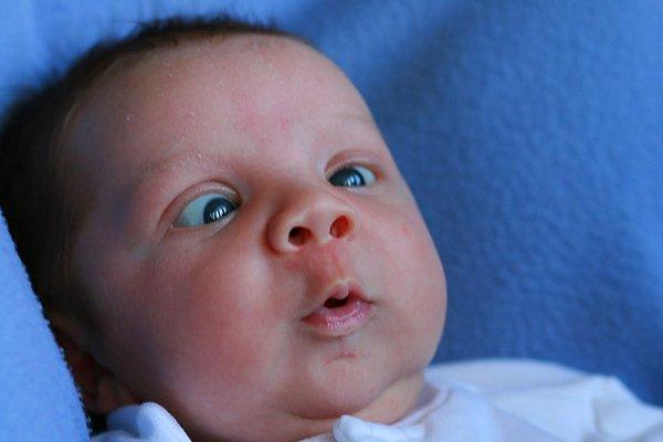Bebeklerde Şaşılık Belirtileri Nelerdir?