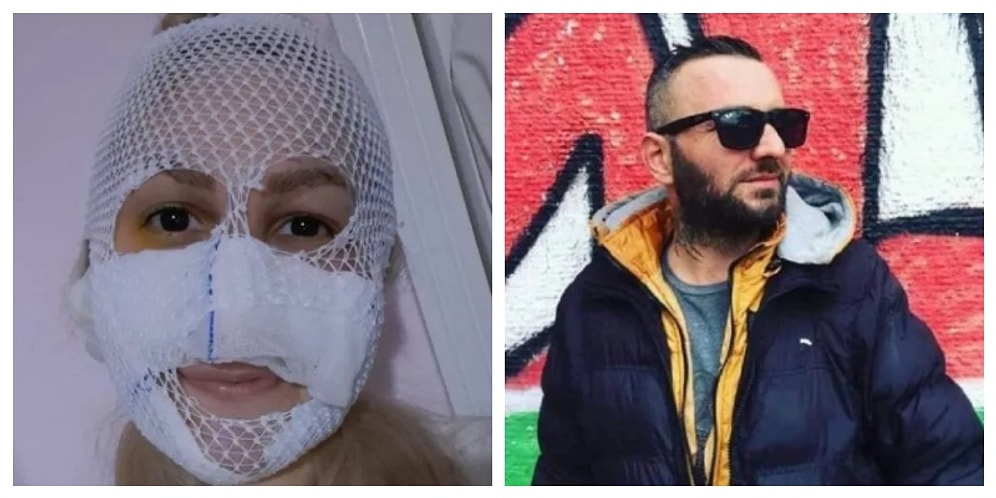 Sultan'ın Yüzünü Yakan Saldırganın Ev Hapsi Kaldırıldı: 'Bu Beni Son Görüşünüz Olabilir'