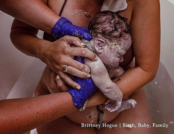 7. Doğum Sonrası: Belgesel isimli kategorinin birincisi, fetüsün cildini kaplayan beyaz, kremsi koruyucu tabakayla bağlı olan yeni doğmuş bebeğin fotoğrafı oldu.