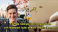 "TikTok Hayatımı Kurtardı!" : Takipçileri Sayesinde Kanserli Benini Fark Ederek Erken Tanı Konulan Fenomen