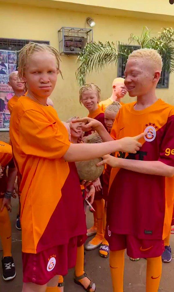 Albino çocuklar Gomis'e teşekkür ederlerken onları düşünen birileri olduğu için çok mutlu olduklarını söylediler.