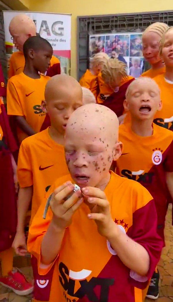 Albino çocuklar Afrika'da çok zorlu şartlarda yaşıyorlar. Birilerinin onları düşündüğünü hissetmeleri bile harika bir his.
