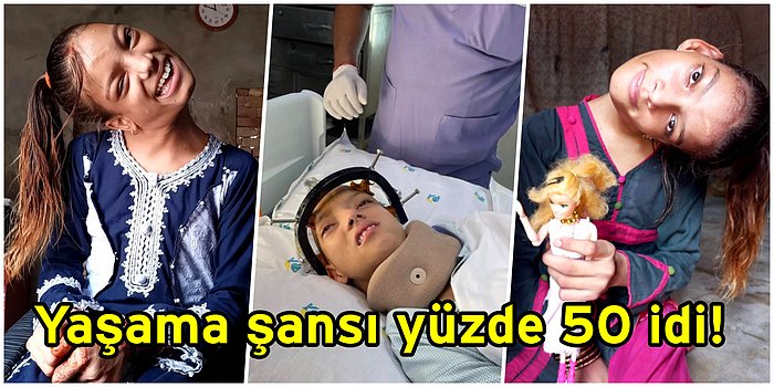 Bebekken Geçirdiği Kaza Sonucunda Boynunu Düz Tutamayan Genç Kızın Mucizevi Ameliyatı Gözlerinizi Yaşartacak!