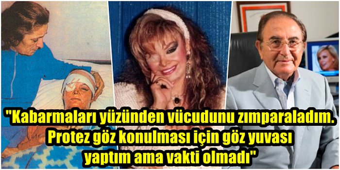 Yüzüne Kezzap Atılan Bergen'in Tedavisini Yapan Ünlü Doktor Onur Erol Yıllar Sonra Canlı Yayında Konuştu!