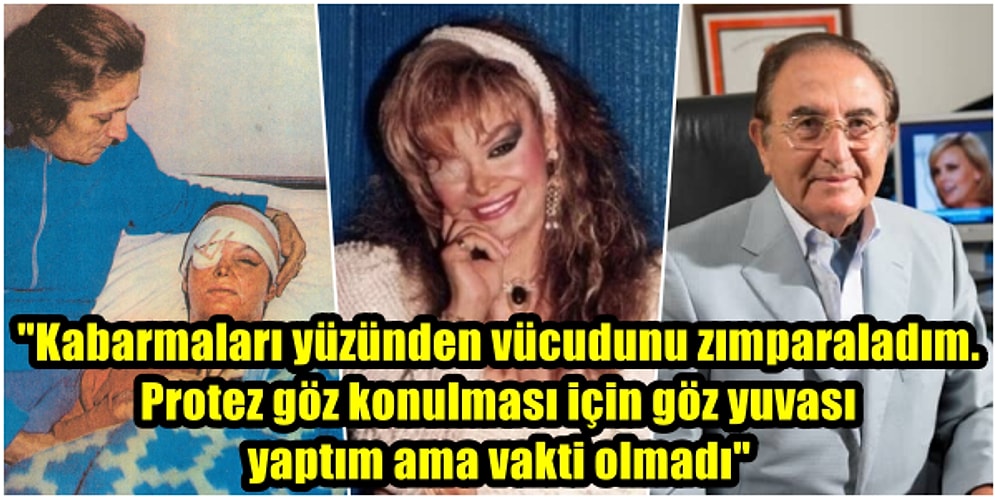 Yüzüne Kezzap Atılan Bergen'in Tedavisini Yapan Ünlü Doktor Onur Erol Yıllar Sonra Canlı Yayında Konuştu!