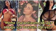 Çocukken Zorbalığa Uğradığı İçin Sayısız Estetik Ameliyat Geçirerek Dış Görünüşünü Komple Değiştiren Kadın