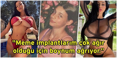 Çocukken Zorbalığa Uğradığı İçin Sayısız Estetik Ameliyat Geçirerek Dış Görünüşünü Komple Değiştiren Kadın