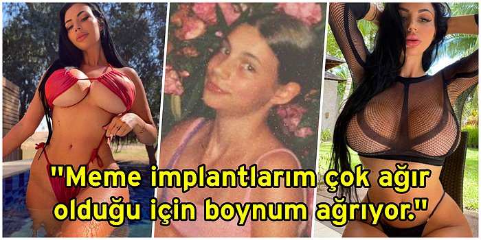 Çocukken Zorbalığa Uğradığı İçin Sayısız Estetik Ameliyat Geçirerek Dış Görünüşünü Komple Değiştiren Kadın