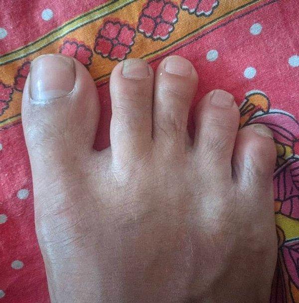 6. "Ortalama bir insan ayağına kıyasla benimki bir garip. Ayak parmağı uzunluğu açısından azalan bir sıra izlemiyor. Orta parmağım ikinci en uzun parmağım."