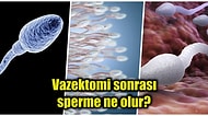 Sperm Kanalları Kapatılarak Gerçekleşen Vazektomiden Sonra Vücutta Kalan Spermlere Ne Olur?