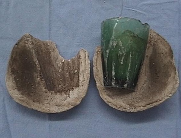 Камни мочевого пузыря представляют собой твердые массы минералов, которые обычно образуются, когда моча не полностью опорожняется из мочевого пузыря.