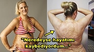 Geçirdiği Kaza Sonucu Dördüncü Derece Yanıkları Olan ve Farkındalık Yaratmak İçin Podyuma Çıkan Kadın