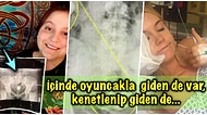 Hayatlarına Renk Katmak İçin Cinsel İlişki Oyuncağı Kullanan Kişilerin Sonu Hastanede Biten Bahtsız Hikayeleri