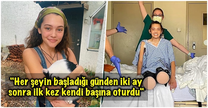 Kovid Nedeniyle İki Bacağı da Kesilen Model Hastanede Geçirdiği Ayların Ardından Taburcu Oldu