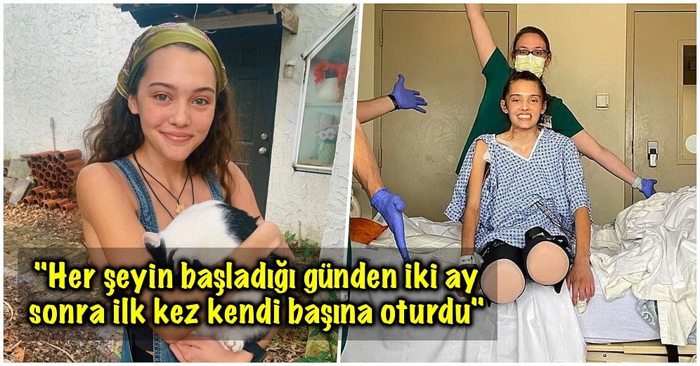 Kovid Nedeniyle İki Bacağı da Kesilen Model Hastanede Geçirdiği Ayların Ardından Taburcu Oldu