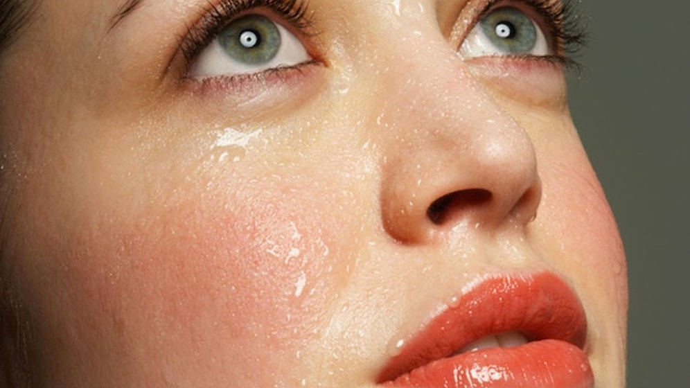 Yüz Terlemesi Nasıl Tedavi Edilir?