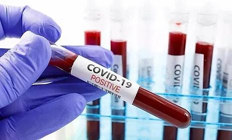 26 Mart 2022 Koronavirüs Tablosu Açıklandı: Bugün Güncel Vaka Sayısı Kaç Oldu? Vaka ve Vefat Sayısı Kaç?