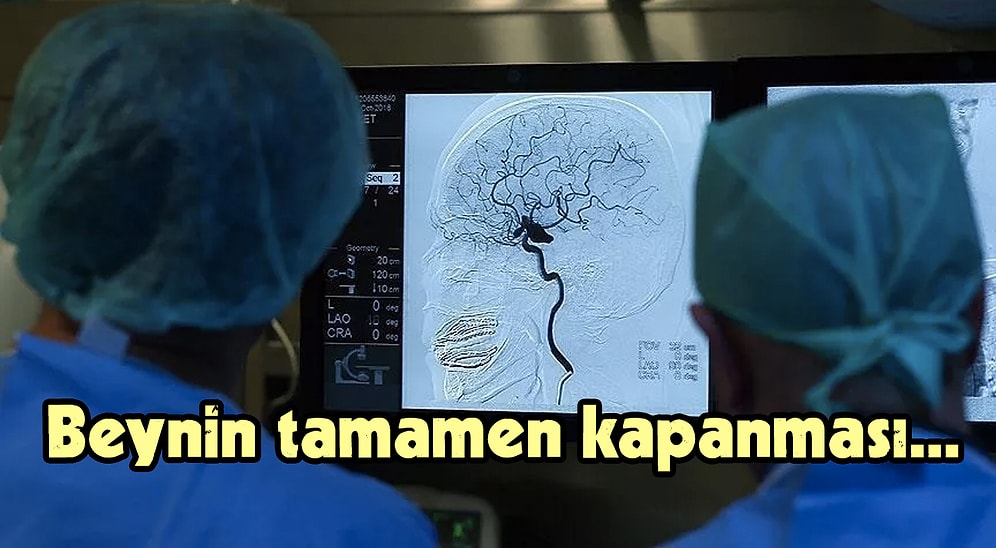 Sinir Bilimci Yanıtladı! Bir İnsanın Bilinci Kafası Bedeninden Ayrıldıktan Sonra Ne Kadar Açık Kalır?