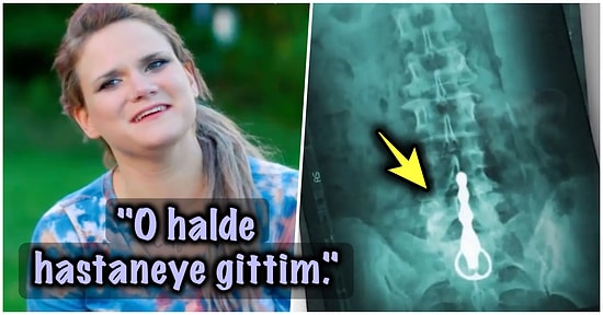 3 Yıldır Bekar Olduğu İçin Cinsel İlişki Oyuncağı Kullanmaya Karar Veren Kadının Sonu Acilde Biten Hikayesi