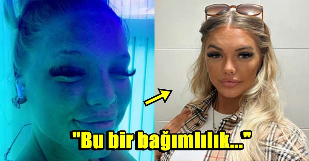 Cilt Kanseri ve Diğer Tüm Riskleri Hiçe Sayarak Haftada 3 Kez Solaryuma Giren Kadının Kafa Yakan Hikayesi