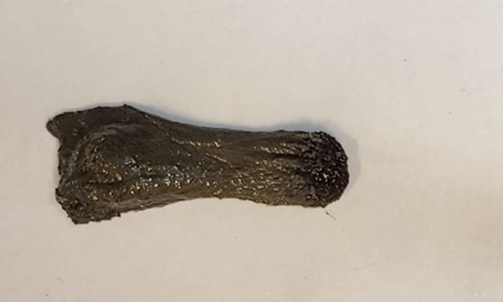 🤖 Manyetik Balçıktan İnsanların Sindirim Sisteminde Kullanılabilecek Robot Geliştirildi!