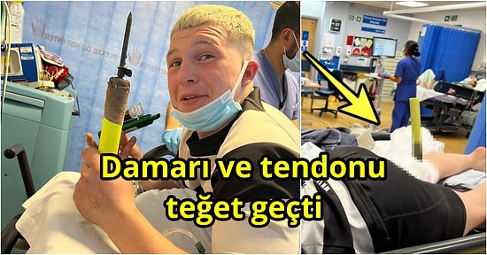 Attığı Sayıya Sevinirken Bacağına Köşe Bayrağı Saplanan Talihsiz Rugby Oyuncusu Charlie Mills