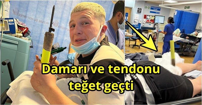 Attığı Sayıya Sevinirken Bacağına Köşe Bayrağı Saplanan Talihsiz Rugby Oyuncusu Charlie Mills