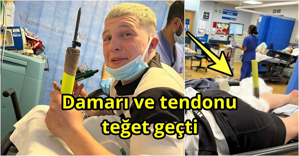 Attığı Sayıya Sevinirken Bacağına Köşe Bayrağı Saplanan Talihsiz Rugby Oyuncusu Charlie Mills