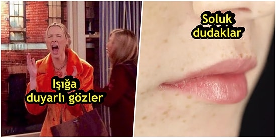 Yalnızca Aynaya Bakarak Vücudunuzda Hangi Vitaminin Eksik Olduğunu Anlayabileceğinizi Biliyor muydunuz?