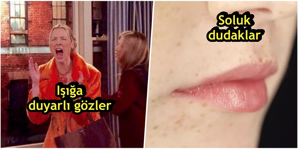 Yalnızca Aynaya Bakarak Vücudunuzda Hangi Vitaminin Eksik Olduğunu Anlayabileceğinizi Biliyor muydunuz?