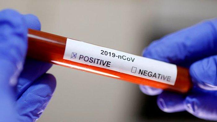 9 Nisan Cumartesi Koronavirüs Tablosu Açıklandı: Bugün Güncel Vaka Sayısı Kaç Oldu? Vaka ve Vefat Sayısı Kaç?