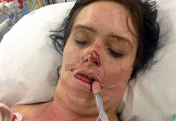 Saldırının ardından hastaneye kaldıran Stacey, 14 gün komada kalmıştı.