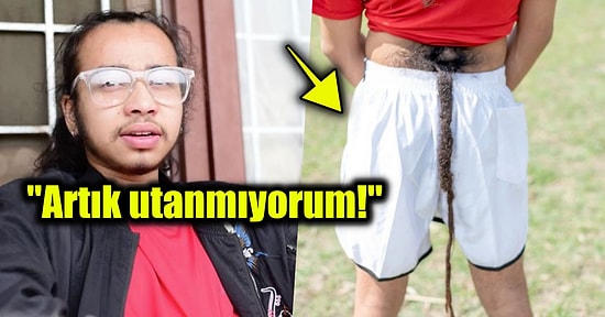 Sırtından Uzayan 70 Santimetrelik Kuyruğuyla İlginçlikte Seviyeyi Allahuekber Dağları'na Çıkaran Çocuk