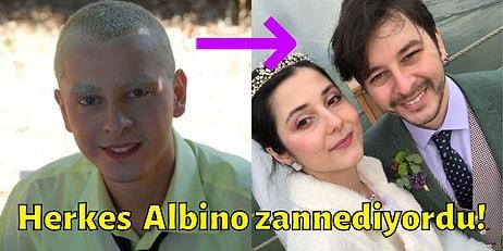 Görenler Tanıyamıyor! Birçok Ünlü İsmin Yer Aldığı Gençlik Dizisi Pis Yedili'nin Albino PC'sinin Gerçek Hali
