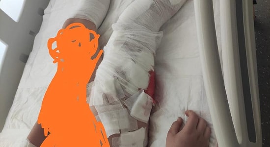 8 Köpek 10 Yaşındaki Çocuğa Saldırdı: Kolları, Bacakları ve Kafasından Yaralandı